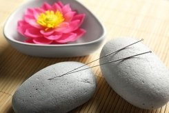 Bild Akupunkturnadeln mit Steinen